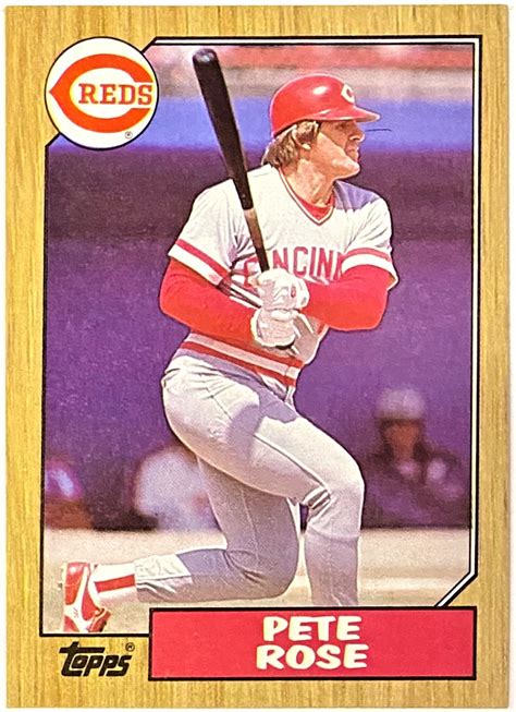 1987 pete rose